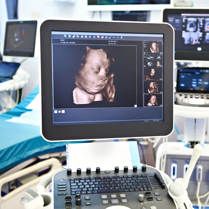 3D Ultrasound In Ottawa Premier Imaging Radiologist